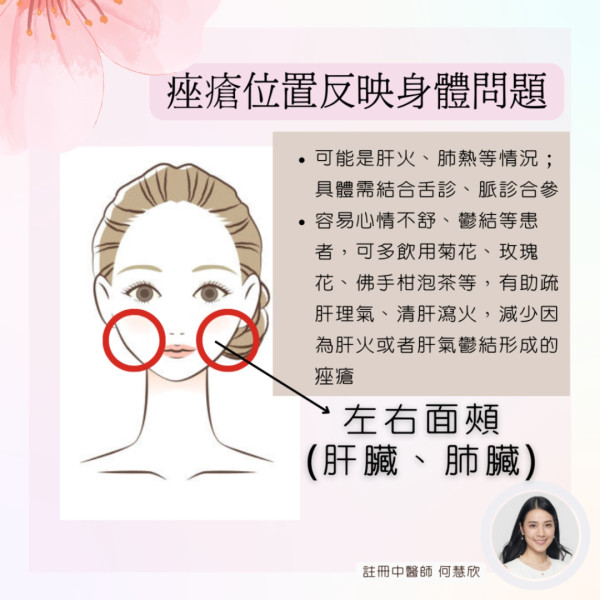 暗瘡4位置成因