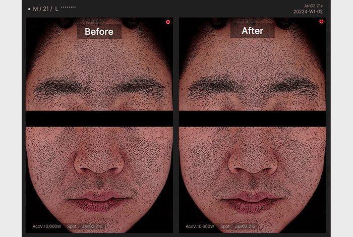medicube ZERO毛孔爽膚棉2.0