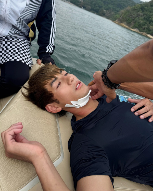 魏浚笙Jeffrey拍戲驚傳嚴重意外 頸部受傷流血險釀毀容事件 公司最新回應