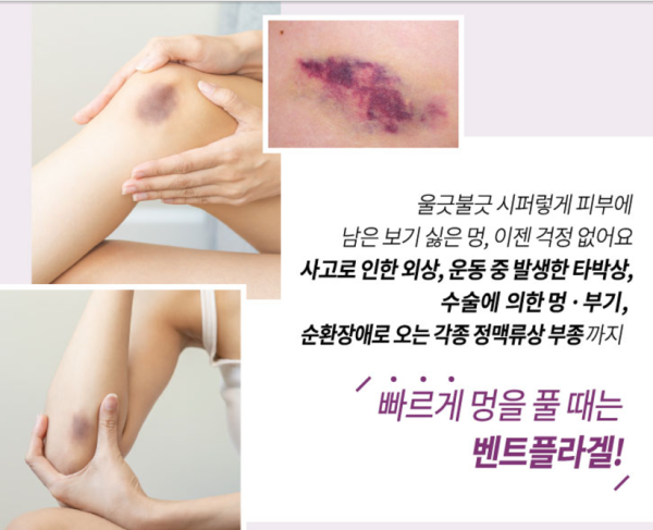 韓國藥局必買｜2. 太極製藥Bentfla Gel去瘀膏