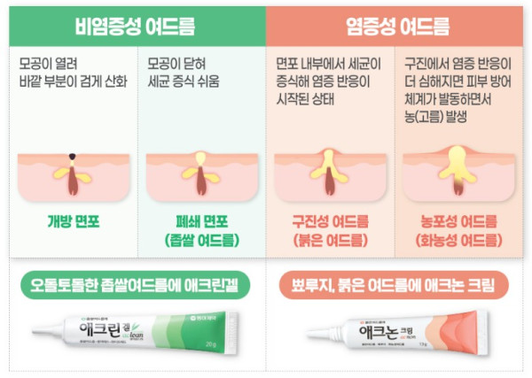 韓國藥局必買｜4. Aclean Gel 黑頭白頭去粉刺啫喱 