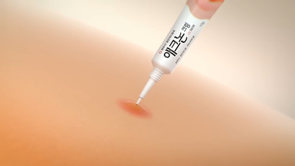 韓國藥局必買｜3. Acnon Cream抗炎殺菌袪痘膏暗瘡膏 