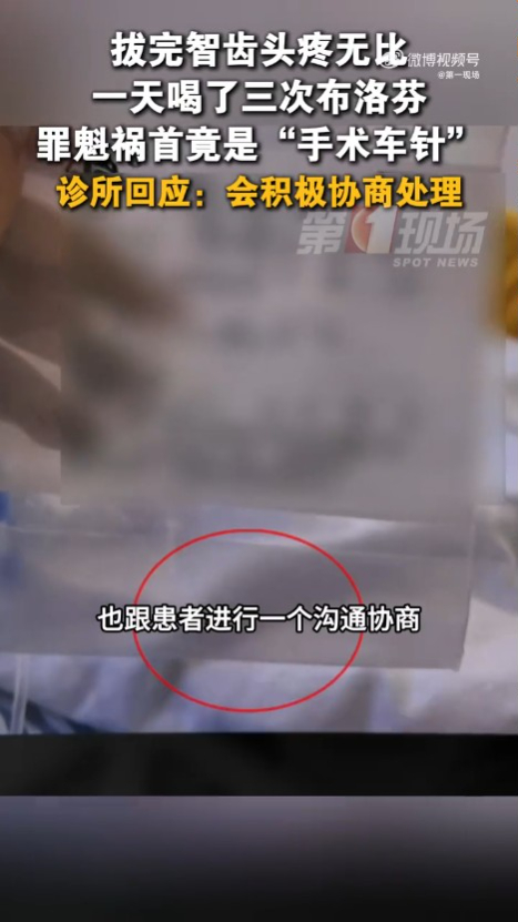 深圳福田拔智齒致頭部劇痛多日 覆診驚見口腔殘留手術針 