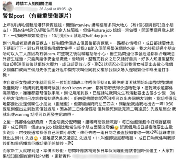 6個月大女嬰被熱水燙傷至脫皮！菲傭稱BB整瀉水壺 醫生指屬意外無法報警？事件後續咁發展...