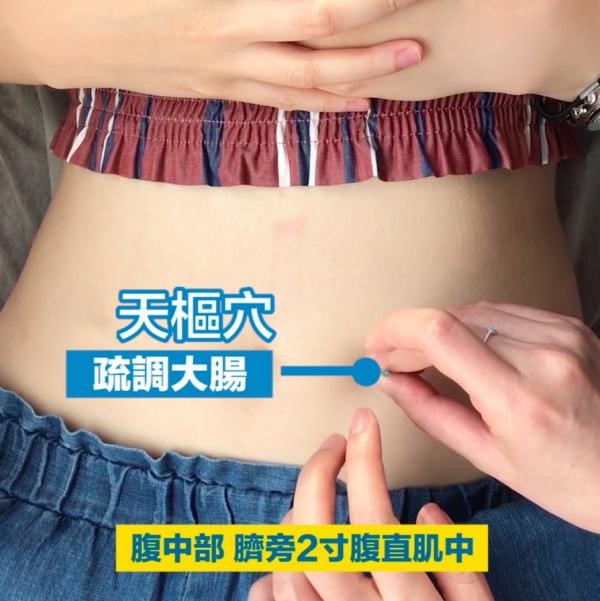 按壓天樞穴能改善腸道功能，緩解便秘。（AI製圖）