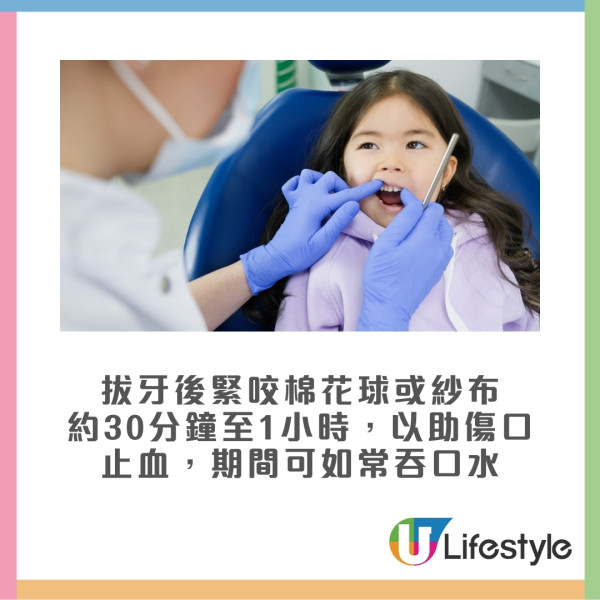 拔牙後7大注意事項