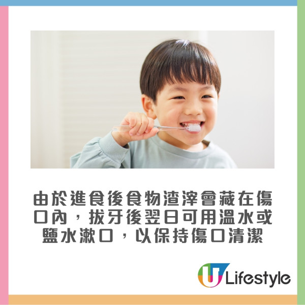 拔牙後7大注意事項