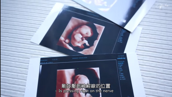Coffee林芊妤宣布懷孕陀第二胎！IG揭老公反應極冷靜：「當你放棄了就自然會有」