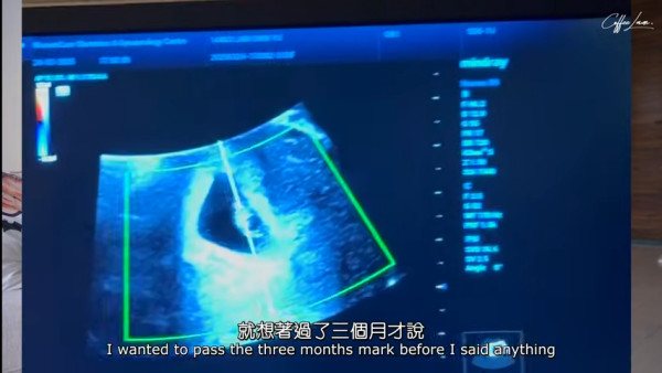 Coffee林芊妤宣布懷孕陀第二胎！IG揭老公反應極冷靜：「當你放棄了就自然會有」