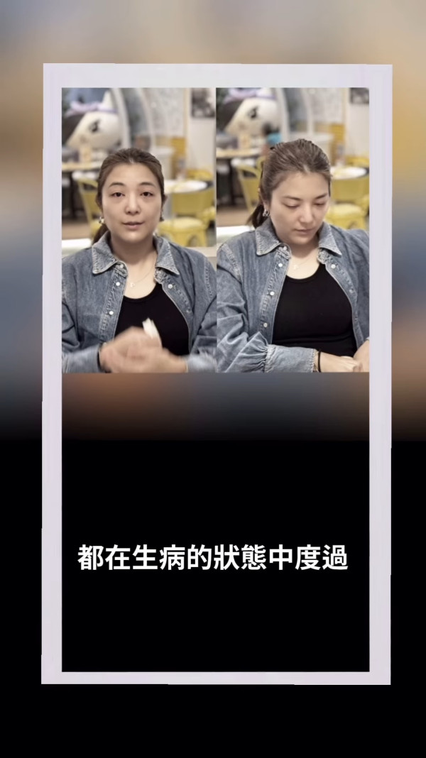 視帝老婆驚爆怪病纏身臉部突然腫脹 發炎病容照觸目驚心：搵唔到原因