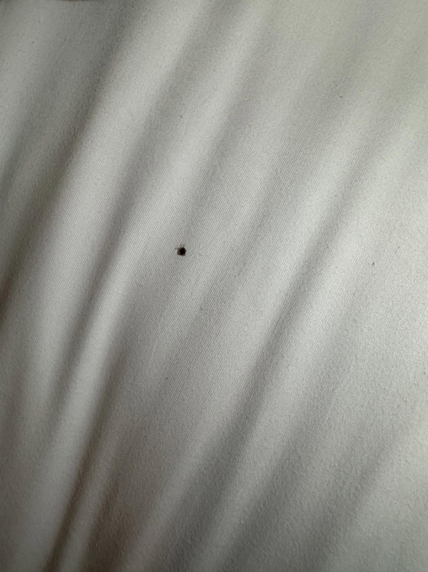 入住酒店疑被床蝨咬至流血!郭子豪現紅腫傷口發文求救 酒店專家教3點防範!