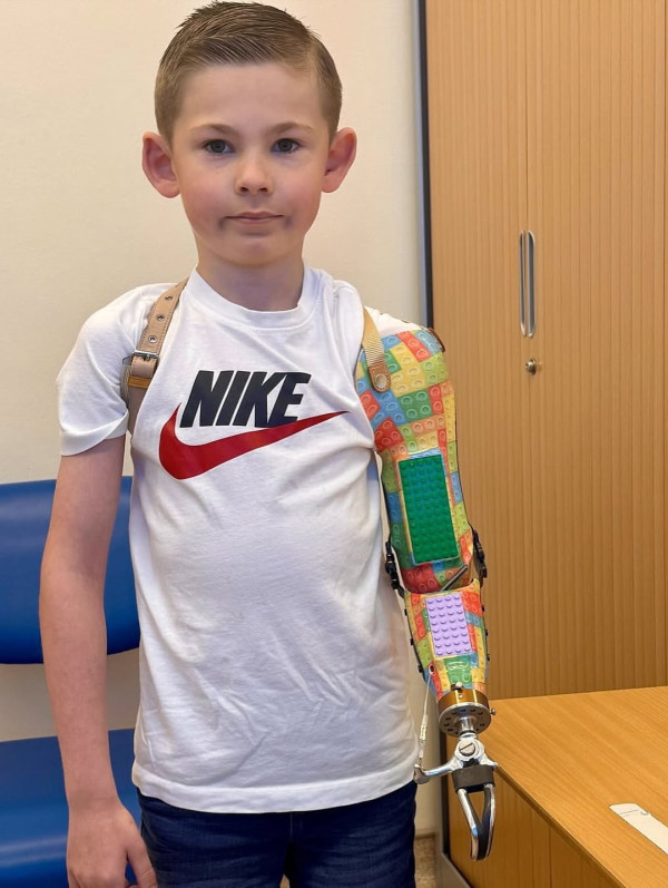 獨臂男孩獲贈LEGO義肢 將身體缺陷化成獨特印記 