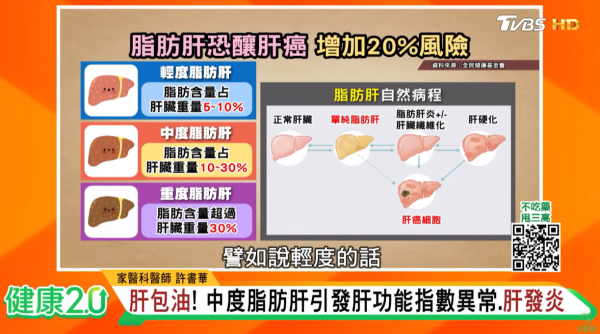 台醫減肥逆轉脂肪肝｜半醣飲食法＋7分鐘運動 減重40磅擊退四高