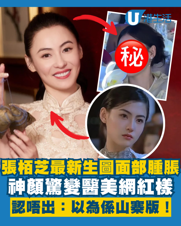 張栢芝最新生圖流出面部腫脹超飽滿 驚變醫美網紅樣認唔出：以為係山寨版