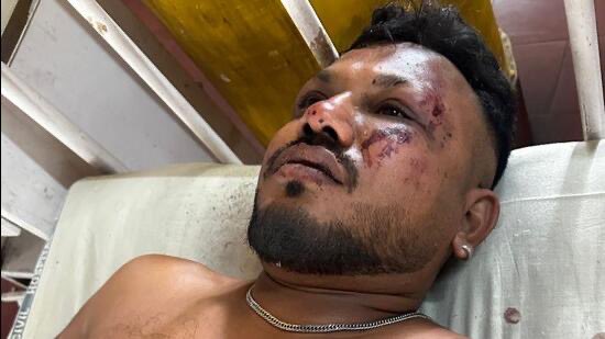 印度航空空難｜全機唯一生還者跳機逃生倖存 專家：8大保命關鍵　教1類座位生還率最高