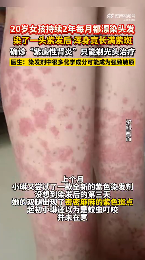 （圖片來源︰微博）