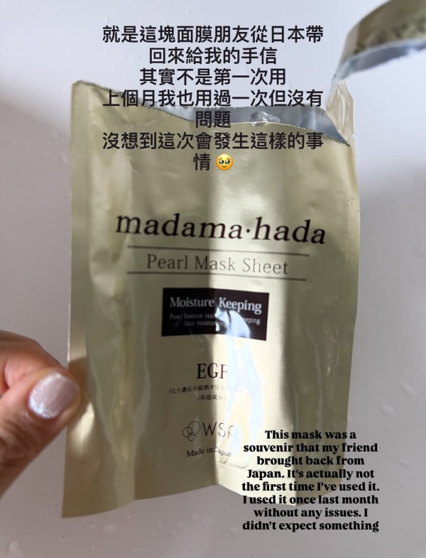 37歲女星敷日本面膜險盲！雙眼強烈刺痛 凌晨掛急症求醫 