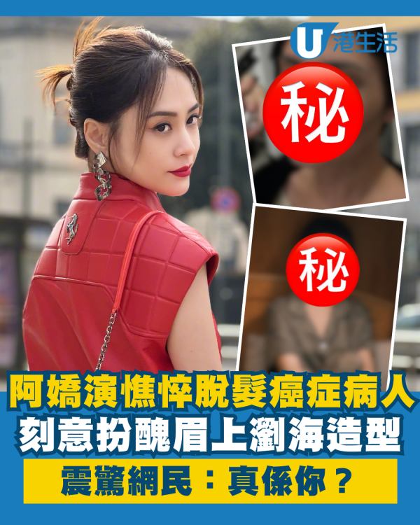 鍾欣潼阿嬌刻意扮醜演脫髮癌症病人 眉上瀏海憔悴造型震驚網民：真係你？