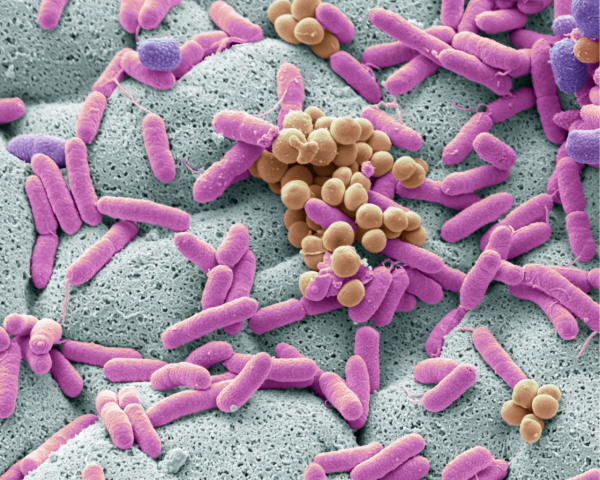 超市1款煙肉受李斯特菌污染 食安中心籲勿食用 3類人嚴重恐致腦膜炎或死亡