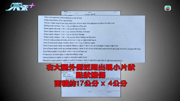 24年前媽媽燒炭案疑有內情大逆轉？孝子追查亡母「乳癌自殺」真相驚揭父親家暴兼外遇