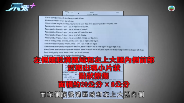 24年前媽媽燒炭案疑有內情大逆轉？孝子追查亡母「乳癌自殺」真相驚揭父親家暴兼外遇