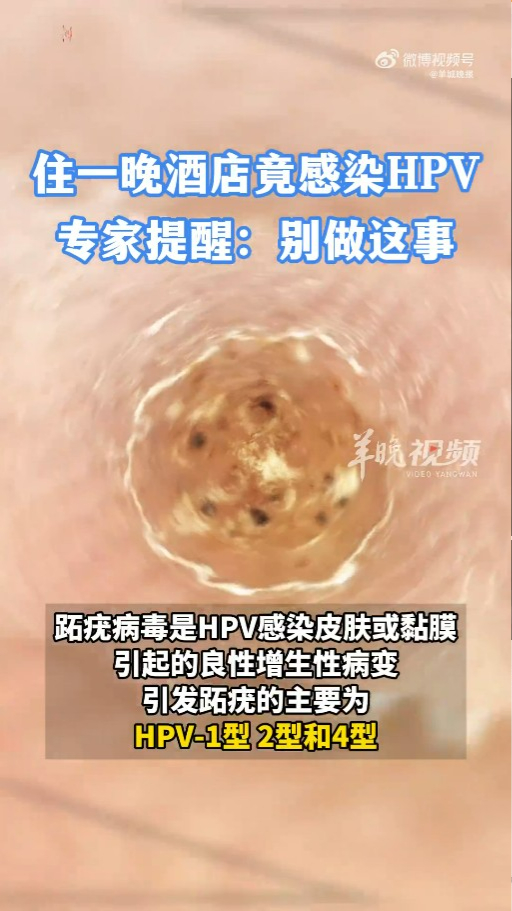 內地連續兩名兒童玩水後感染「食腦蟲」死亡！專家指一旦感染致死率達98% 