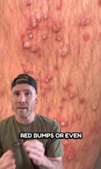 （圖片來源︰IG@drjoe_md）