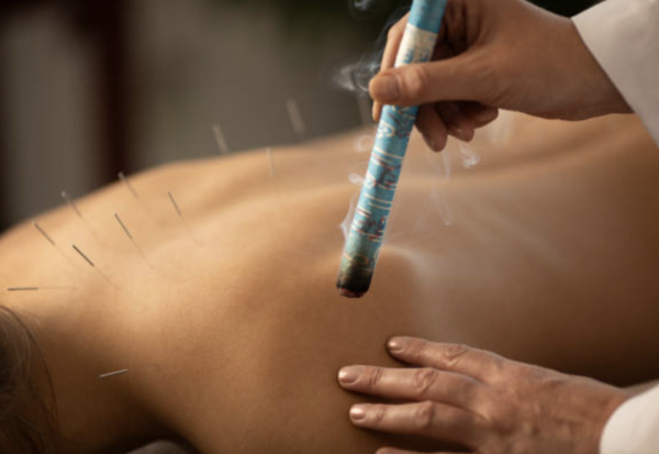 艾灸 圖片來源:iStock