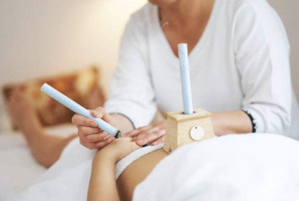 艾灸 圖片來源:iStock