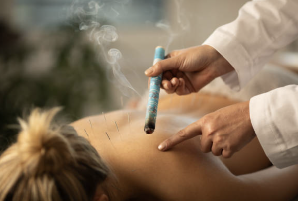 艾灸 圖片來源:iStock