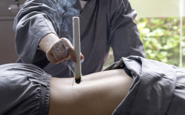 艾灸 圖片來源:iStock