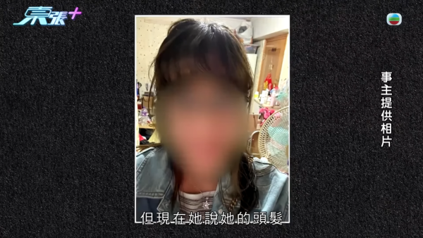 貪靚港女醫「鬼剃頭」打針生髮慘變禿頭 怒控診所不負責任：我36歲你搞到我似66歲！