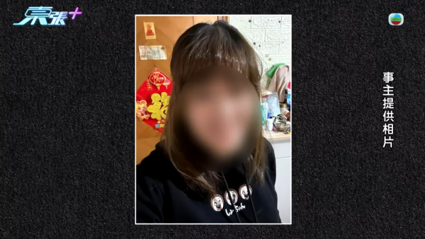 貪靚港女醫「鬼剃頭」打針生髮慘變禿頭 怒控診所不負責任：我36歲你搞到我似66歲！