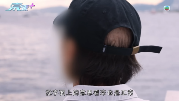 貪靚港女醫「鬼剃頭」打針生髮慘變禿頭 怒控診所不負責任：我36歲你搞到我似66歲！