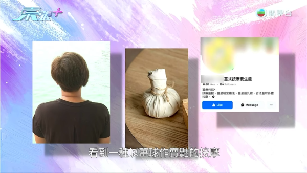港媽「薑球按摩」慘變二級燒傷，節目截圖，圖片來源︰東張西望。