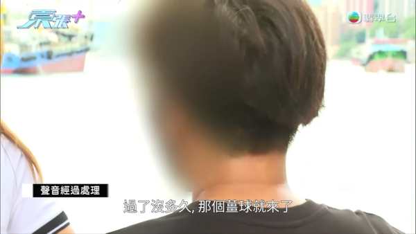 港媽「薑球按摩」慘變二級燒傷，節目截圖，圖片來源︰東張西望。