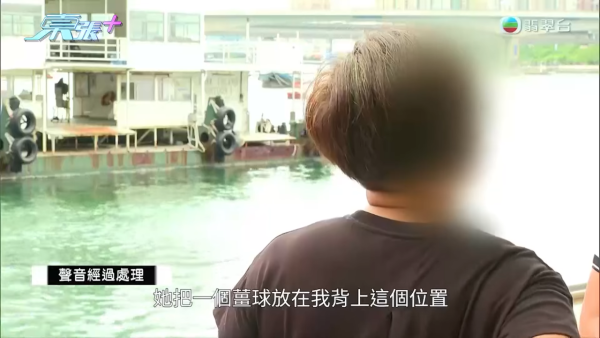 港媽「薑球按摩」慘變二級燒傷，節目截圖，圖片來源︰東張西望。