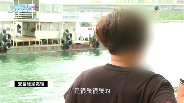 港媽「薑球按摩」慘變二級燒傷，節目截圖，圖片來源︰東張西望。