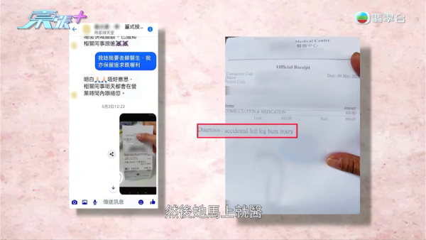 港媽「薑球按摩」慘變二級燒傷，節目截圖，圖片來源︰東張西望。