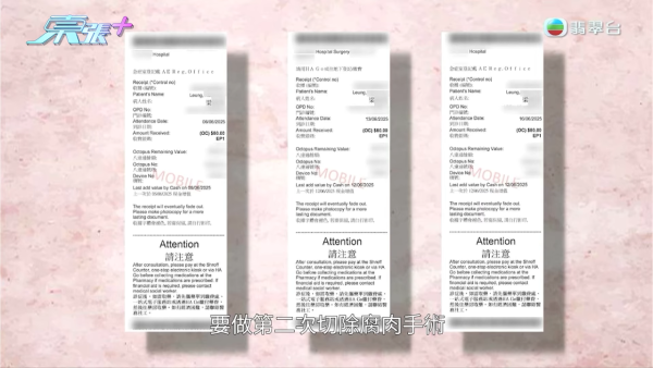 港媽「薑球按摩」慘變二級燒傷，節目截圖，圖片來源︰東張西望。