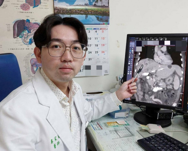 66歲男皮膚發黃驚患膽管癌末期 醫生︰初期症狀不明顯易被忽略延醫