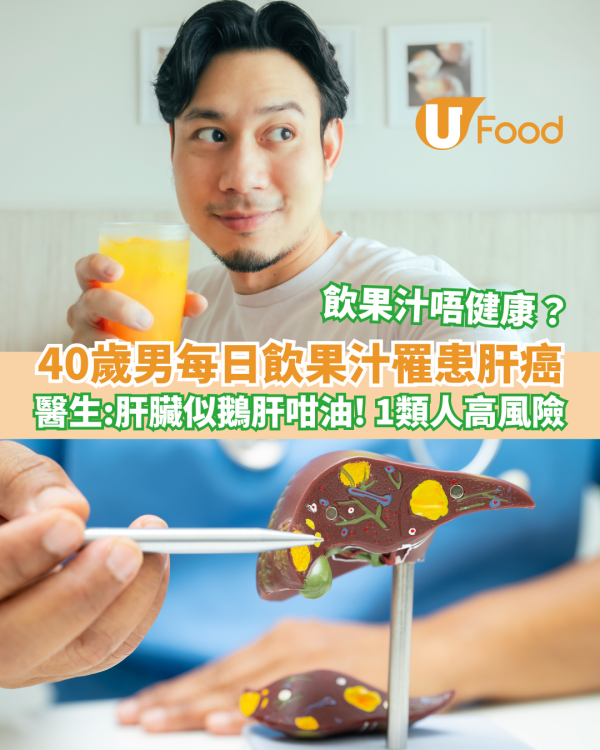 40歲男每日飲果汁罹患肝癌 醫生：肝臟似鵝肝咁油／飲果汁唔一定健康？