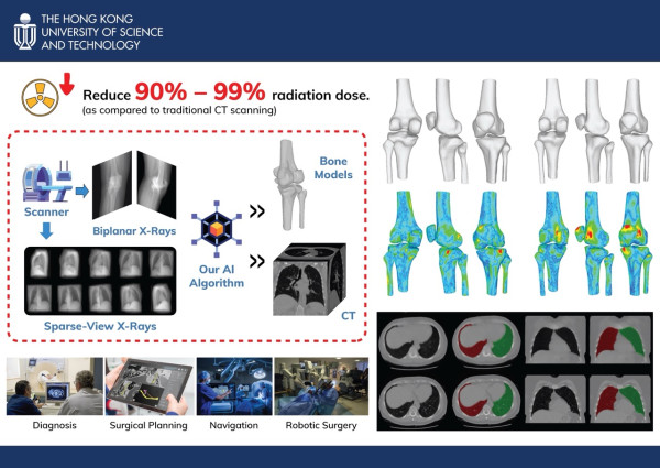 醫療新里程！科大AI技術僅用X光片秒速建構3D骨骼模型 輻射量勁減99%