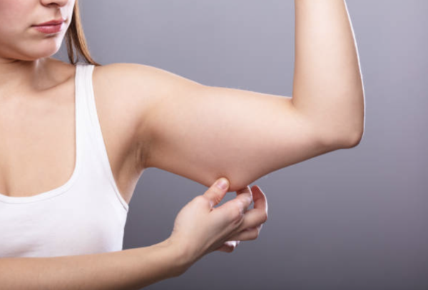 瘦手臂 圖片來源：iStock