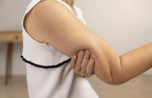 瘦手臂 圖片來源：iStock