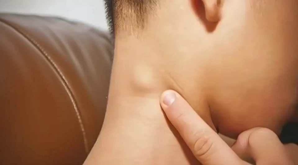 淋巴結腫大︱5歲男頸部生腫塊患末期癌症 營養師教吃3食物助抗癌