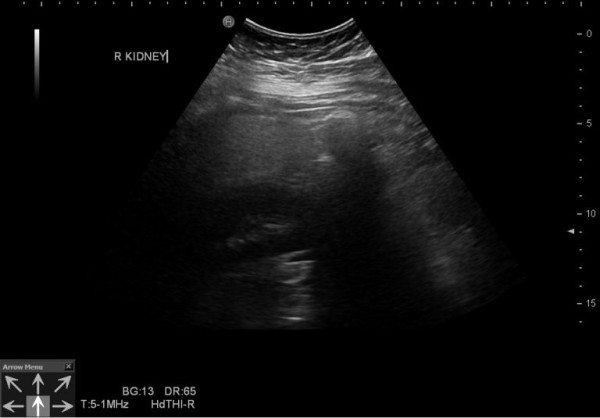 13歲少年久坐玩手機逾10小時 確診中度脂肪肝！營養師推12食物助護肝