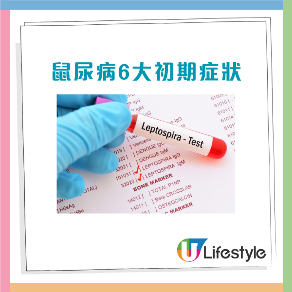 23歲男子喝飲品染「鼠毒病」身亡 全因做漏1動作 必睇6大初期症狀保命