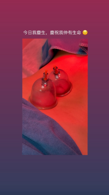 身體出現病況（圖片來源：IG@ginleeginlee）