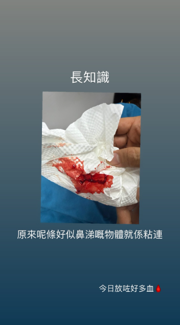 一線索令網民懷疑李幸倪剛做手術（圖片來源：IG@ginleeginlee）